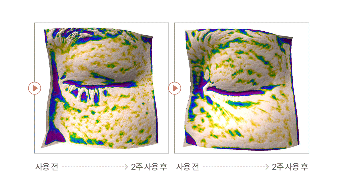 셀루닉 엔케이 액티베이터 패치