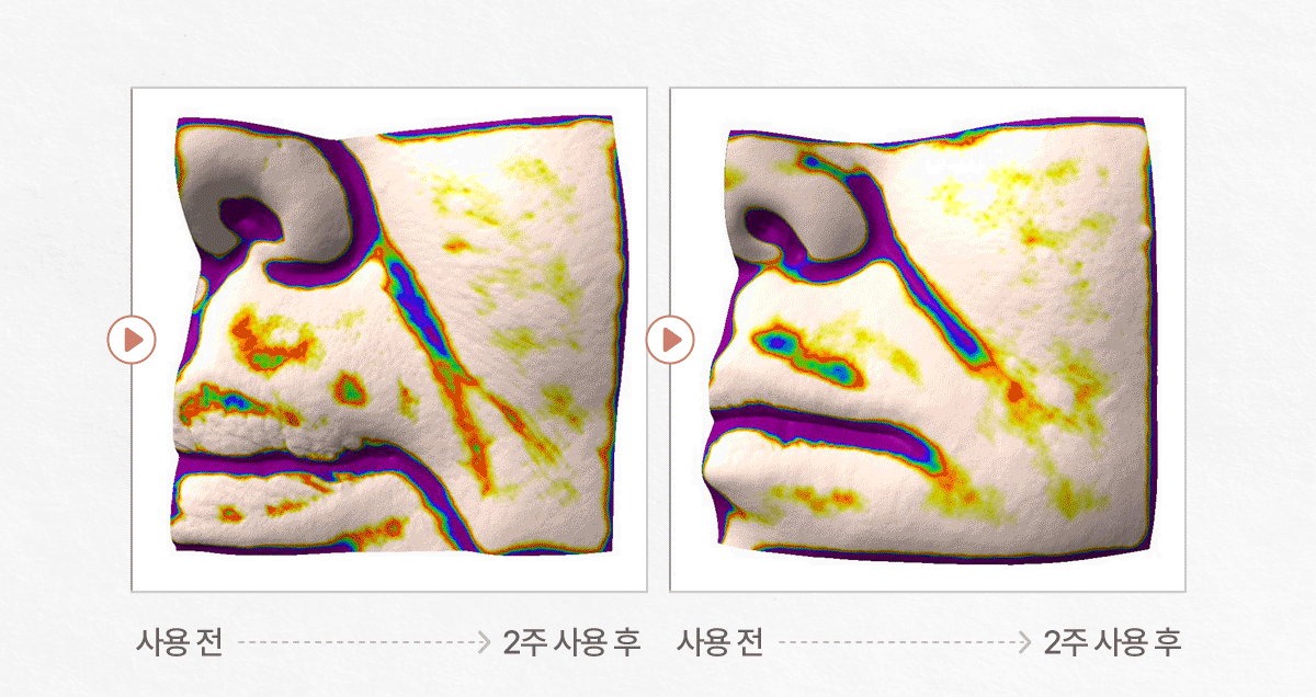 셀루닉 엔케이 액티베이터 패치