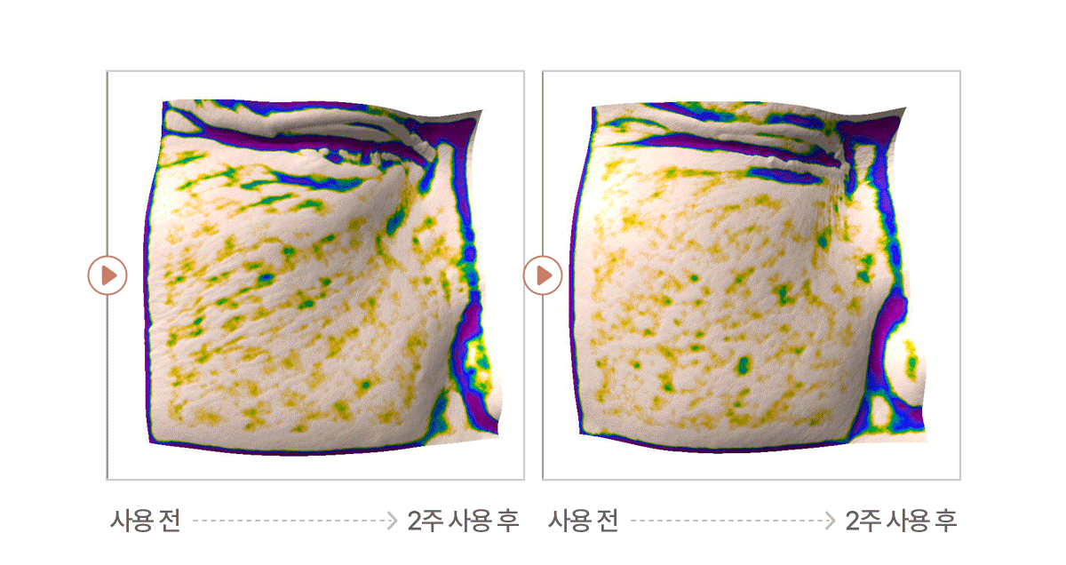셀루닉 엔케이 액티베이터 앰플